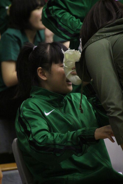 鼻骨を骨折した趙婉晴（ジャオ・ワンチン）