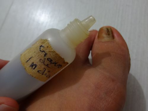 爪水虫に使われる丁子を使った薬