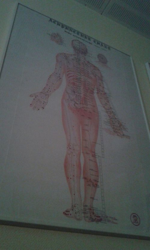 クリニックには大抵、鍼を打つツボの場所などが描かれたポスターが張られています。